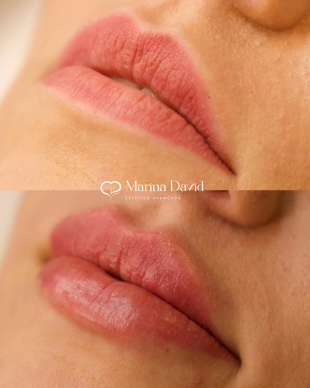 ⸻✨ Lábios perfeitamente desenhados, hidratados e naturais.Um toque de elegância, volume na medid